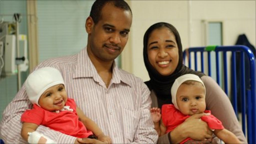 "It's a great gift" say parents of separated twins - BBC News