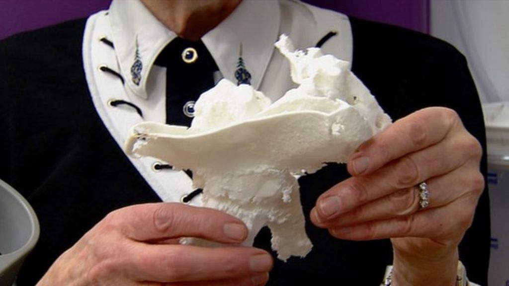 Plastic bones could save the NHS thousands of pounds BBC News