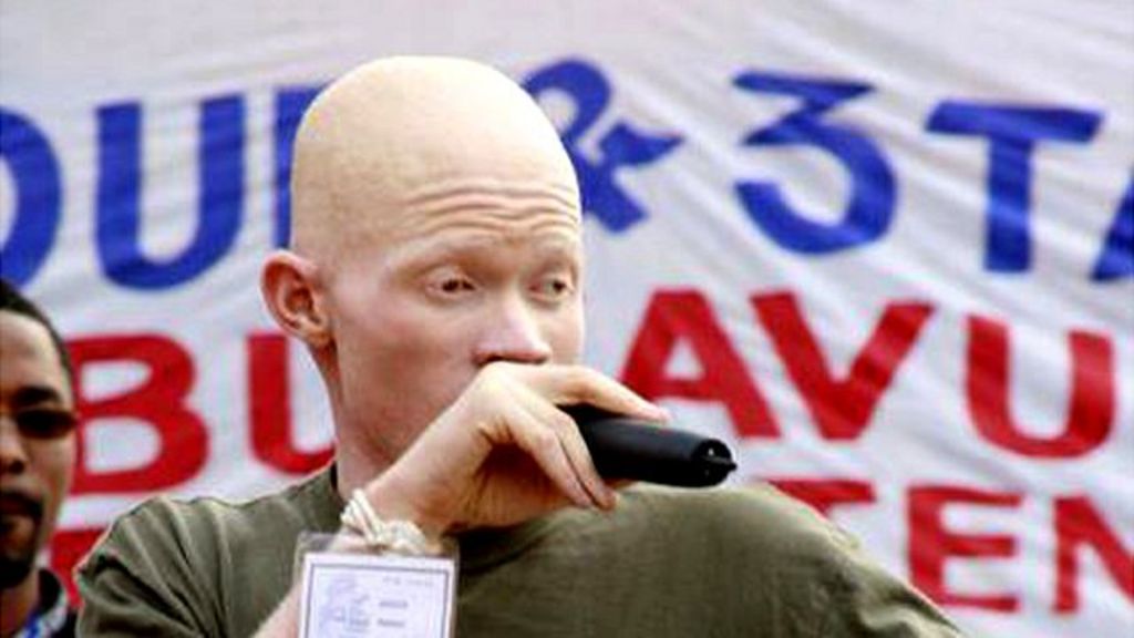 DR Congo rapper N'Kashh on albino attacks BBC News