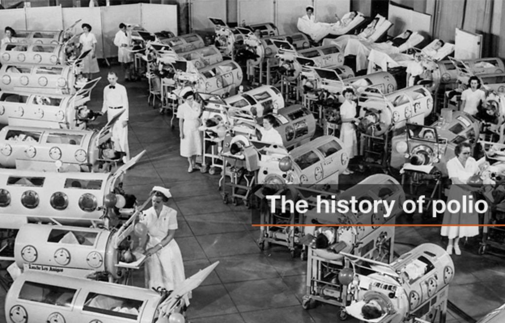 History Of Polio BBC News