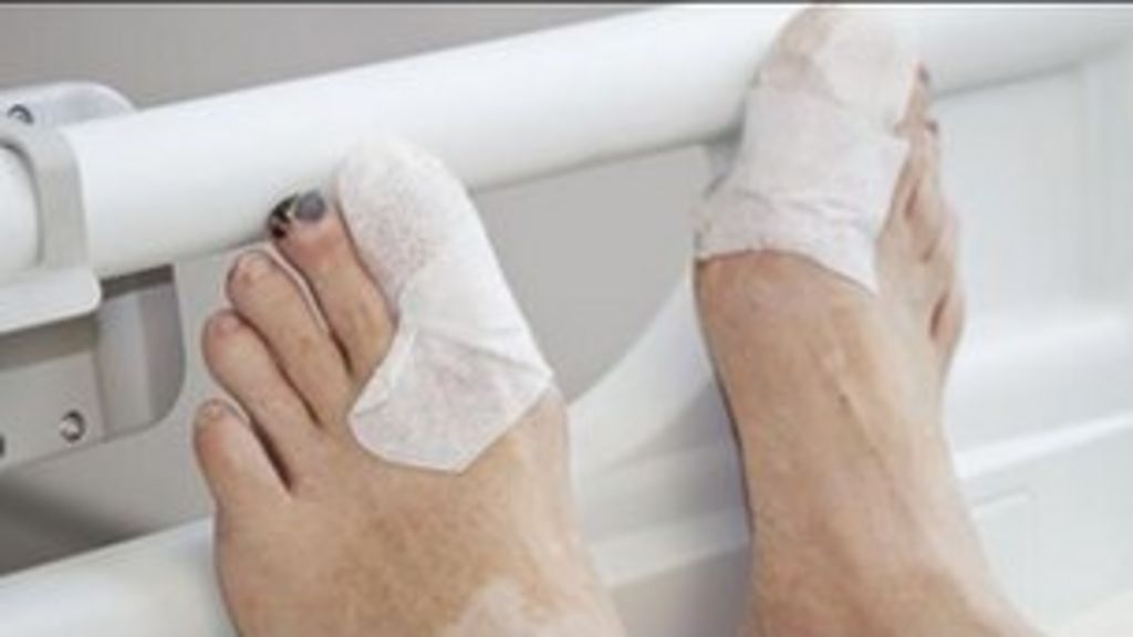 Feet First For Diabetes Patients Bbc News