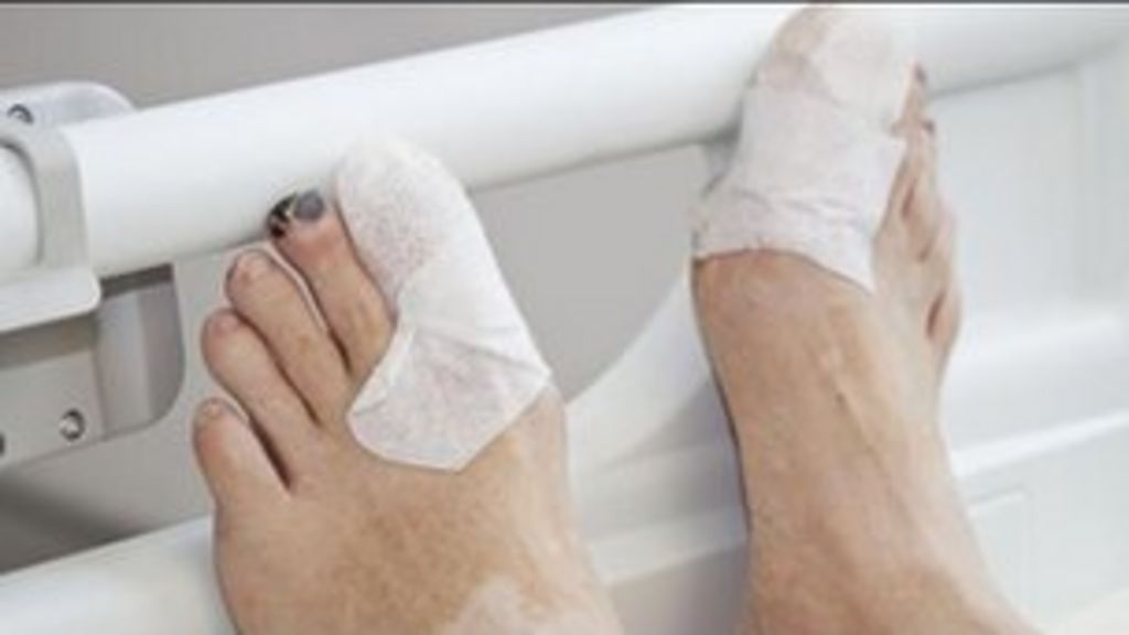 'Feet first' for diabetes patients BBC News