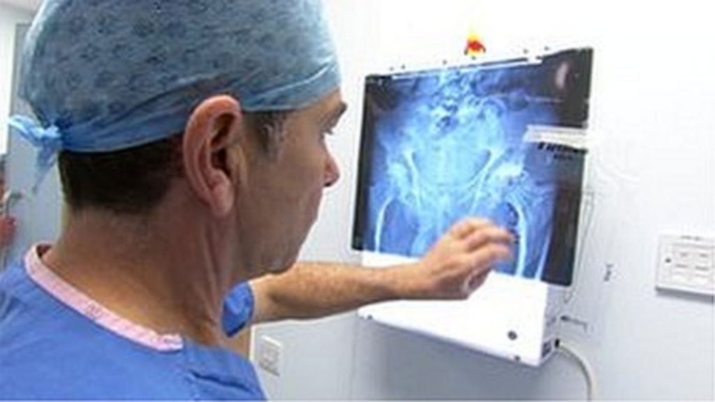 Hip replacement device helps to halve recovery time BBC News
