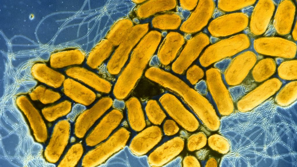 Сальмонеллез бактерия. Сальмонелла Enteritidis. Сальмонеллез. Люминесцентная (флуоресцентная) микроскопия. Сальмонелла холисмообификаус.