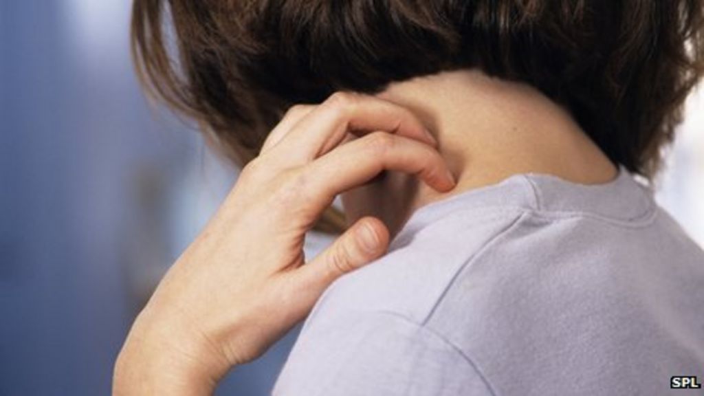 Itching study 'finds chemical that makes us scratch' BBC News