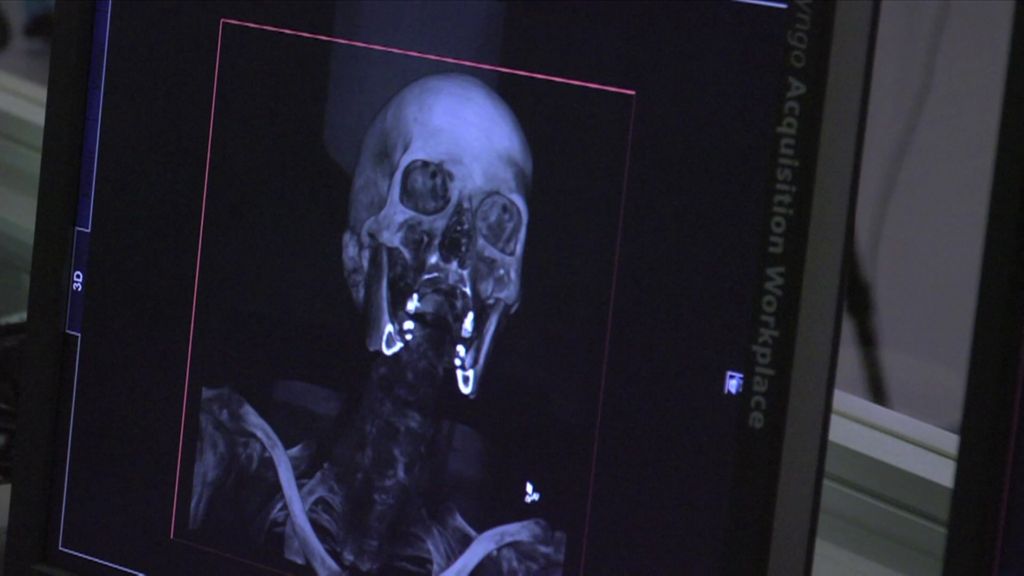 The virtual autopsy BBC News