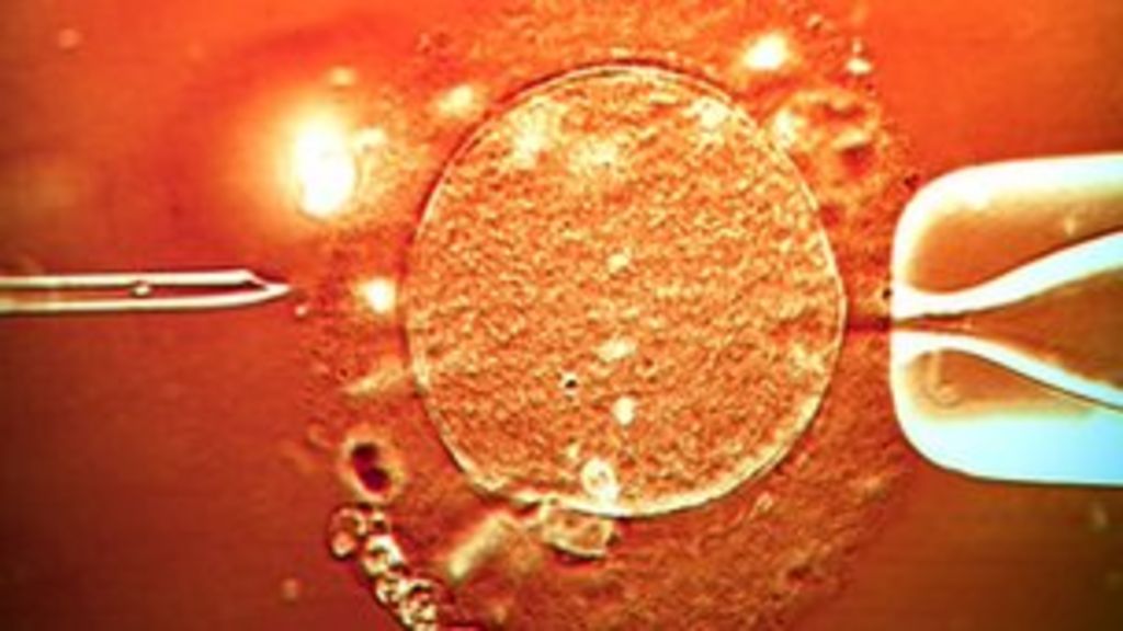 ivf-as-cheap-as-170-doctors-claim-bbc-news