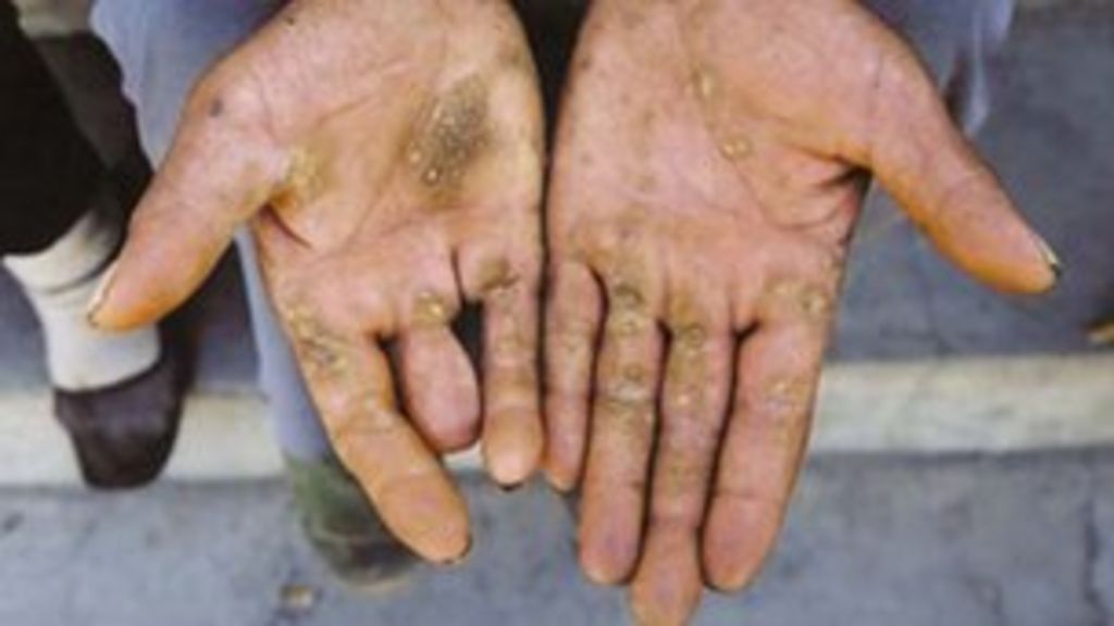 China's arsenic contamination risk is assessed BBC News