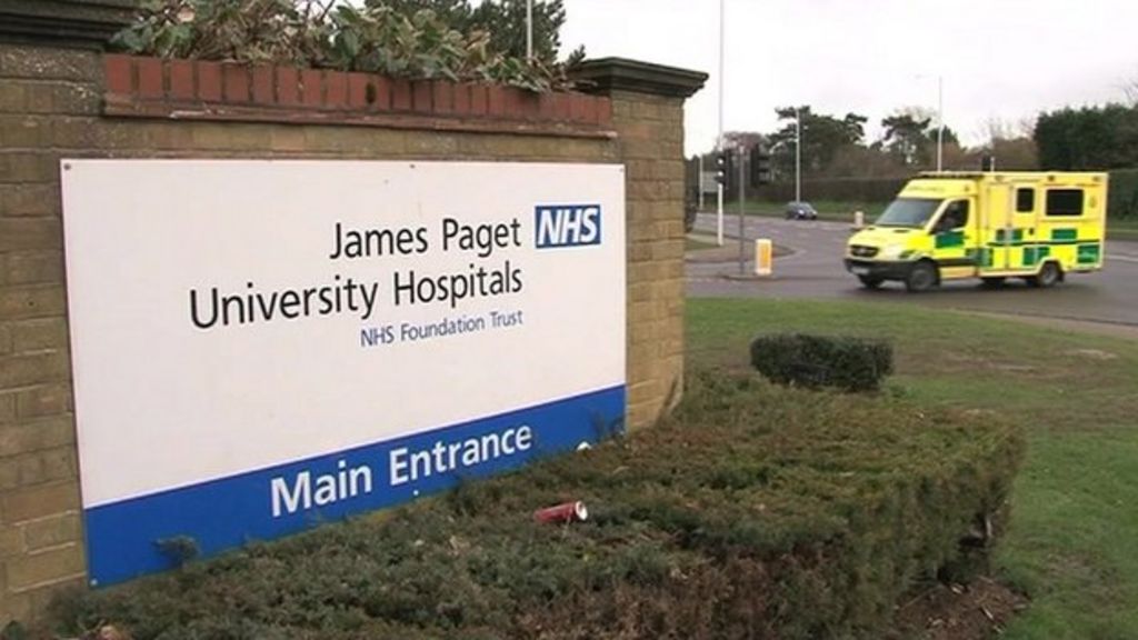 James Paget Hospital hit by lightning BBC News