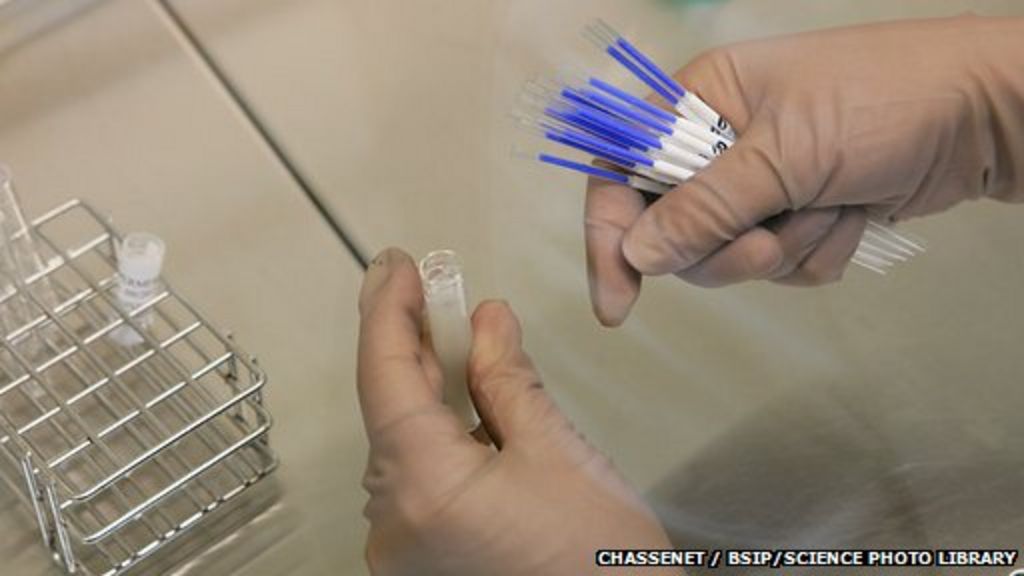 Sperm test for infertile men could reduce surgery BBC News