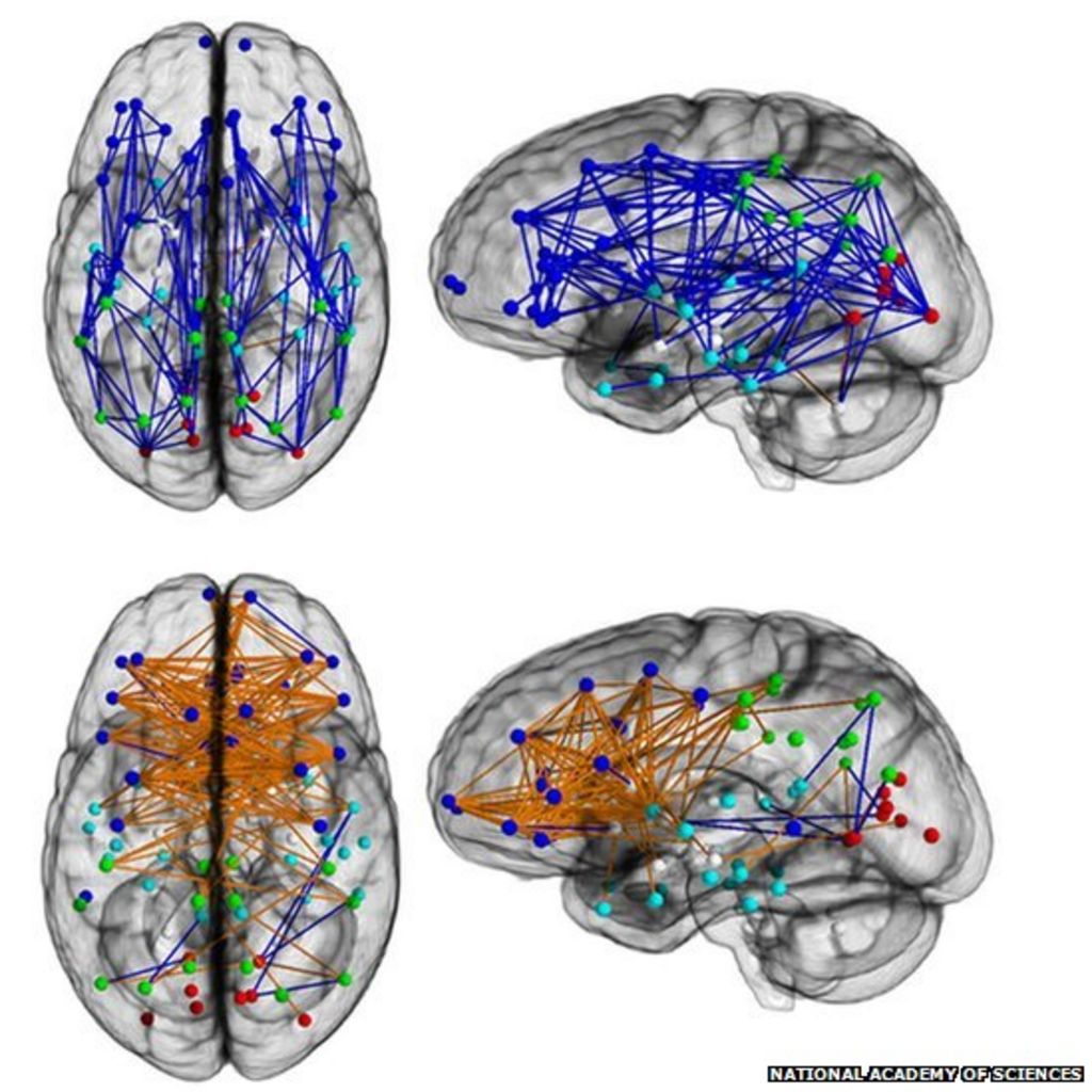Men And Womens Brains Are Wired Differently Bbc News 6639
