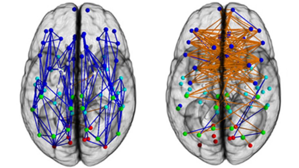 Men And Women S Brains Are Wired Differently BBC News