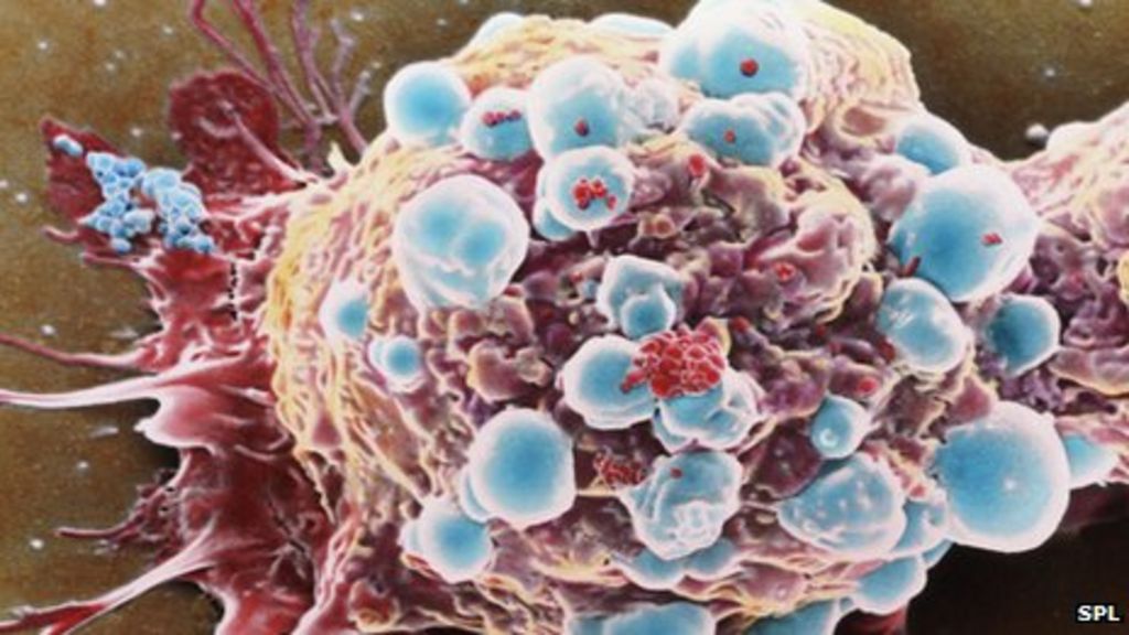 sticky-balls-may-stop-cancer-spreading-bbc-news