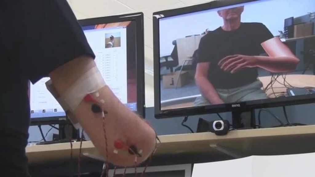 Virtual arm eases phantom limb pain BBC News
