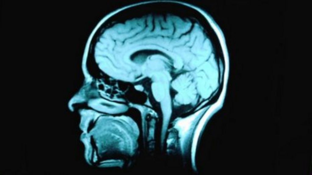 Alcohol-related brain damage report highlights concerns