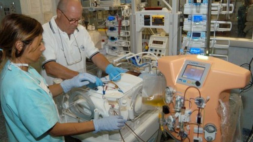 Kidney dialysis machine 'miniaturised' for babies BBC News