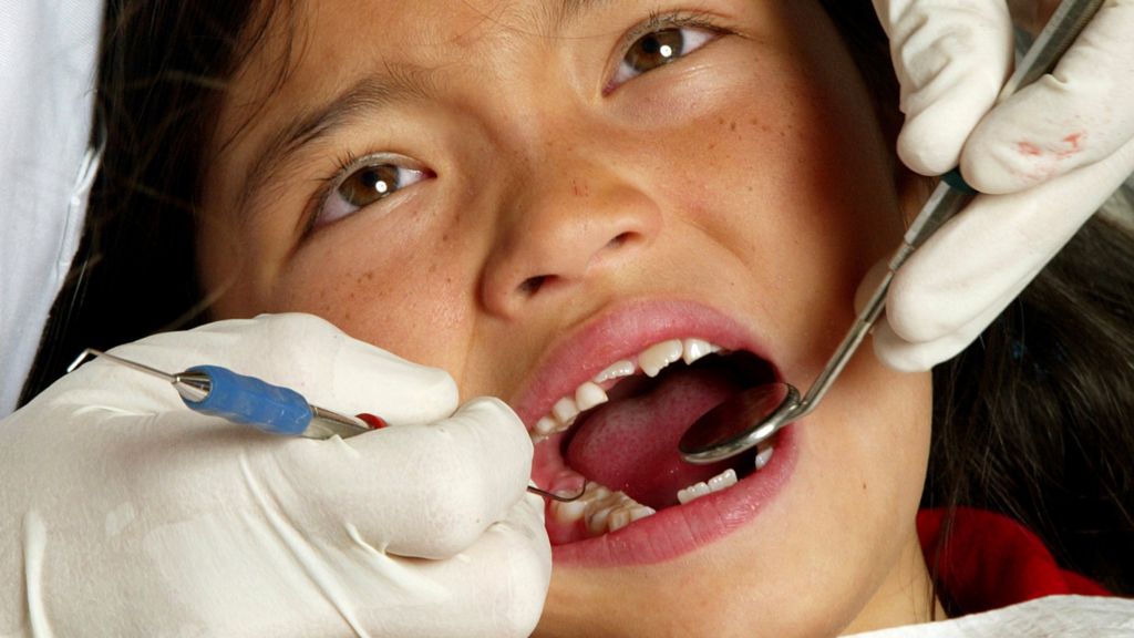 Dental Charity Blames Bad Baby Teeth On Child Neglect Bbc News