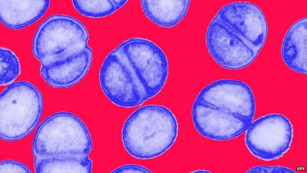 Mrsa Anaerobic Or Aerobic The Shocking Truth - uc8wetn