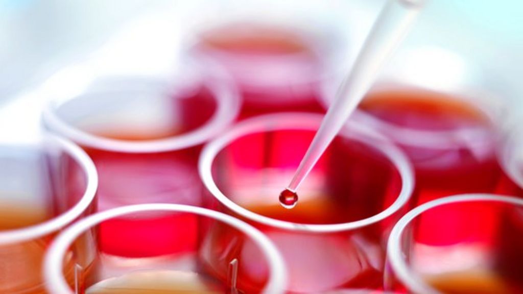 Stem cell transplant death what went wrong BBC News