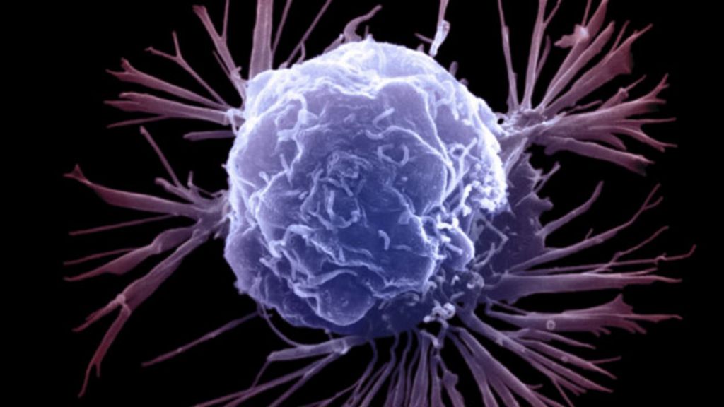 So Is Cancer Mostly Bad Luck Or Not Bbc News