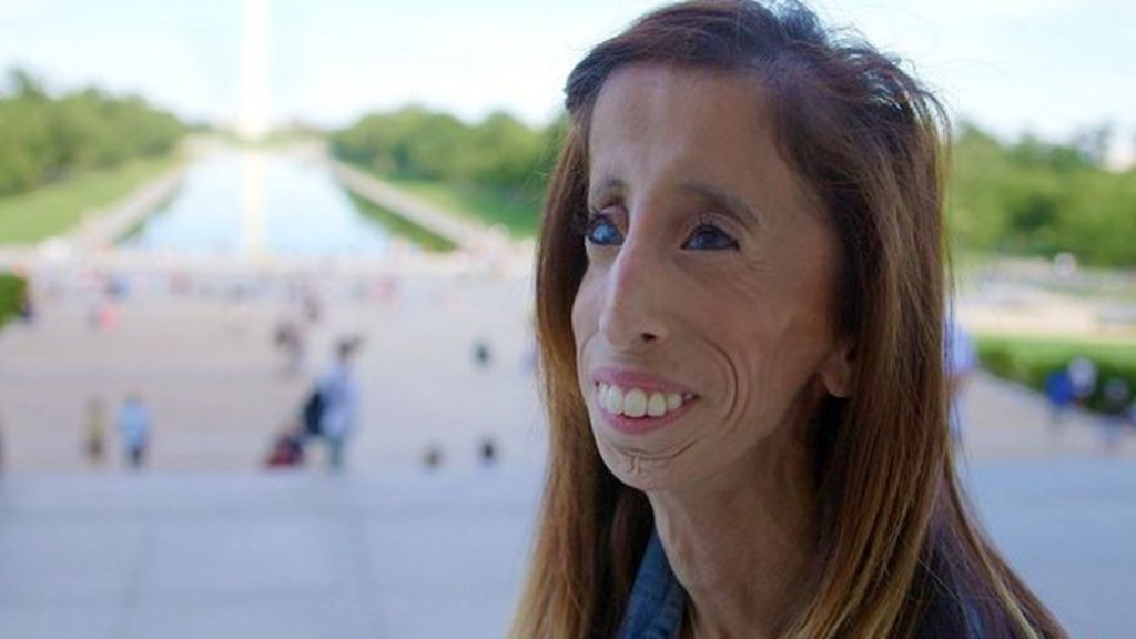 Lizzie Velasquez Online Bullies Called Me The World S Ugliest Woman Bbc News