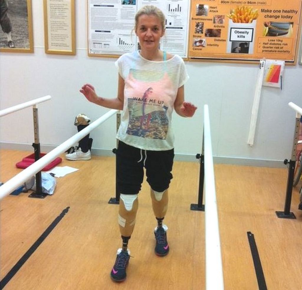 Rochford Leg Amputee Mum Tracy Ralph Begins Rehabilitation Bbc News 