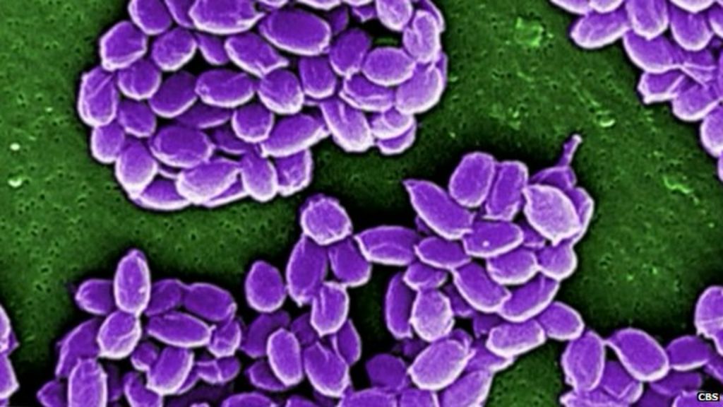 Live Anthrax Shipped Accidentally To S Korea And US Labs BBC News    83268603 Anthrax2 