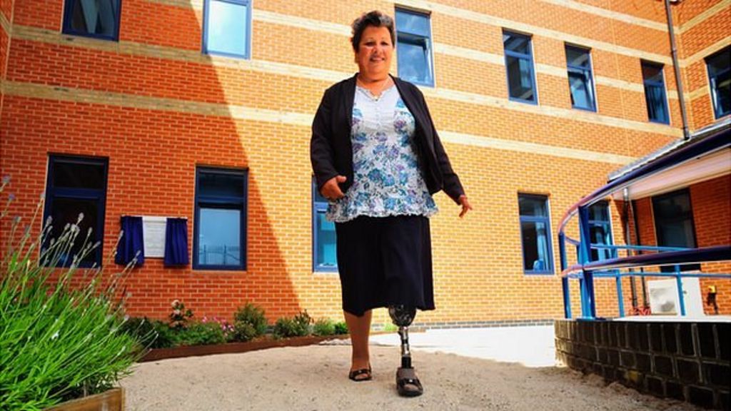 How do amputees learn to walk again? BBC News