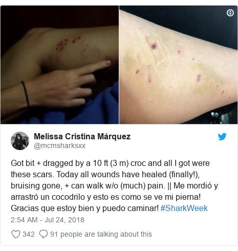 Twitter post by @mcmsharksxx: Got bit + dragged by a 10 ft (3 m) croc and all I got were these scars. Today all wounds have healed (finally!), bruising gone, + can walk w/o (much) pain. || Me mordió y arrastró un cocodrilo y esto es como se ve mi pierna! Gracias que estoy bien y puedo caminar! #SharkWeek 