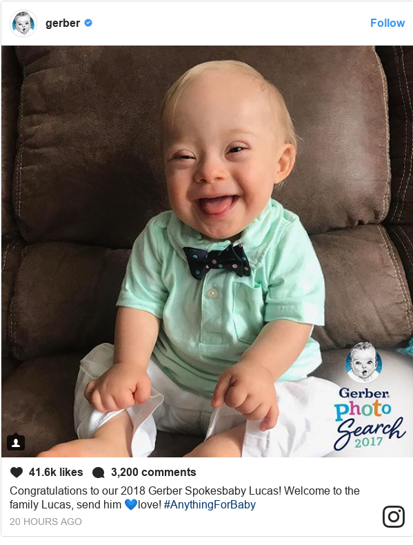gerber baby with downs
