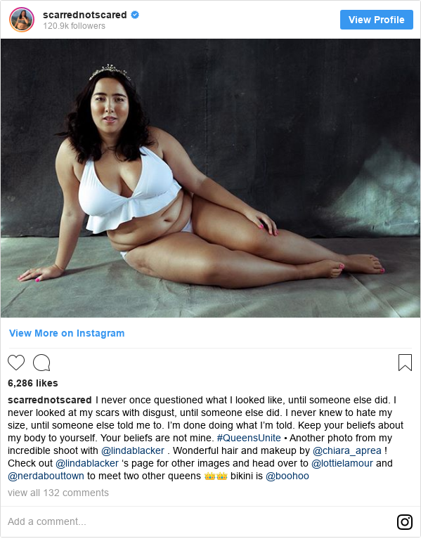Instagram post by scarrednotscared: I never once questioned what I looked like, until someone else did.
I never looked at my scars with disgust, until someone else did.
I never knew to hate my size, until someone else told me to.
I’m done doing what I’m told.
Keep your beliefs about my body to yourself.
Your beliefs are not mine. #QueensUnite
•
Another photo from my incredible shoot with @lindablacker . Wonderful hair and makeup by @chiara_aprea ! Check out @lindablacker ‘s page for other images and head over to @lottielamour and @nerdabouttown to meet two other queens 👑👑 bikini is @boohoo