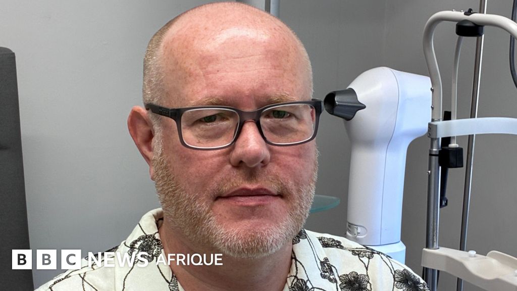 Avertissement concernant l'éclipse solaire de 2026 : un homme souffrant de lésions oculaires permanentes met en garde contre ce sujet.