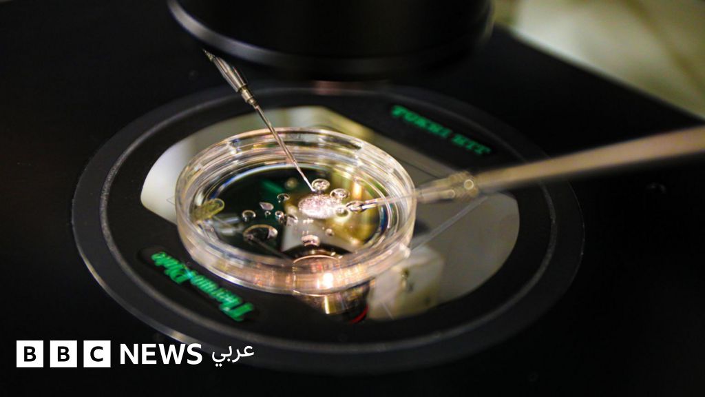 علماء يصنعون أجنة من الحمض النووي لجلد الإنسان لأول مرّة - BBC News عربي