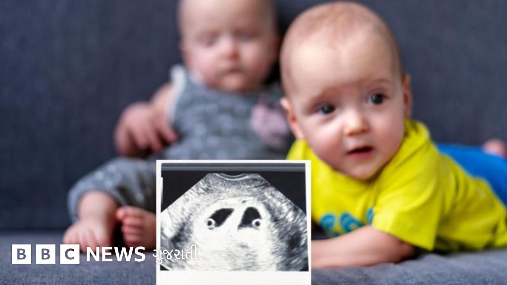 IVF: જોડિયાં કે ત્રણ બાળકોની માન્યતા સહિત 12 સવાલોના જવાબ