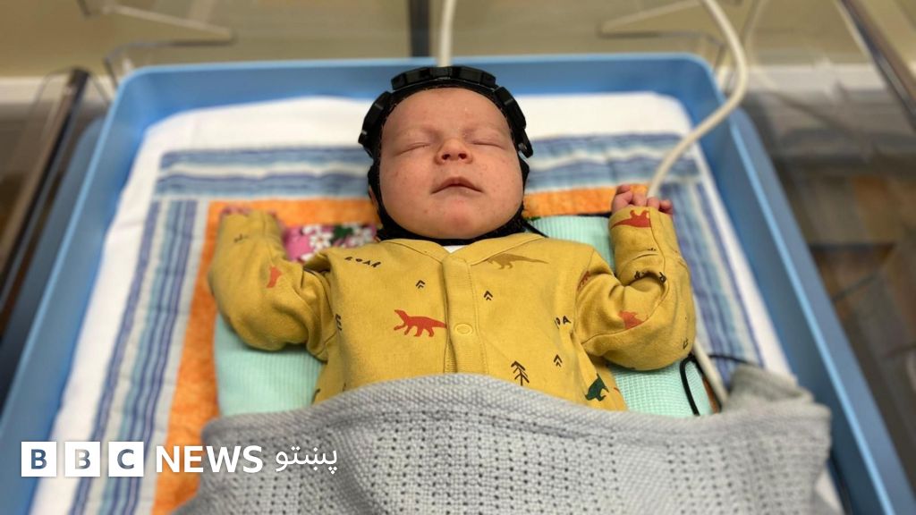 بریتانیا: په نويو زیږېدولو ماشومانو کې د مغز د ټپ د تشخیص په اړه نوې ...