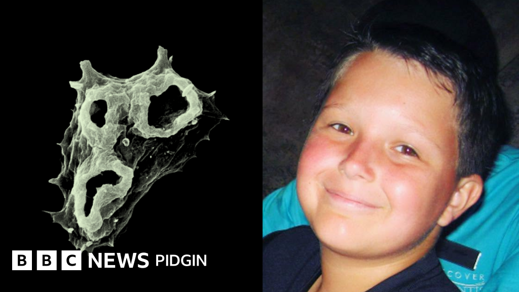 What is Brain-eating amoeba? Di tiny organism called Naegleria fowleri infections wey kill pikin fit spread worldwide, scientists warn  Pidgin