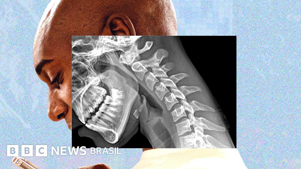 Mãos fracas e visão turva: estamos ficando com 'corpo de celular'?