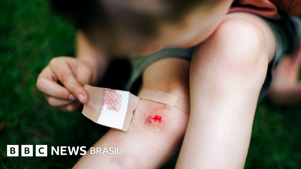 Mercurocromo: o remédio tóxico que quase todo mundo usava para machucados de crianças