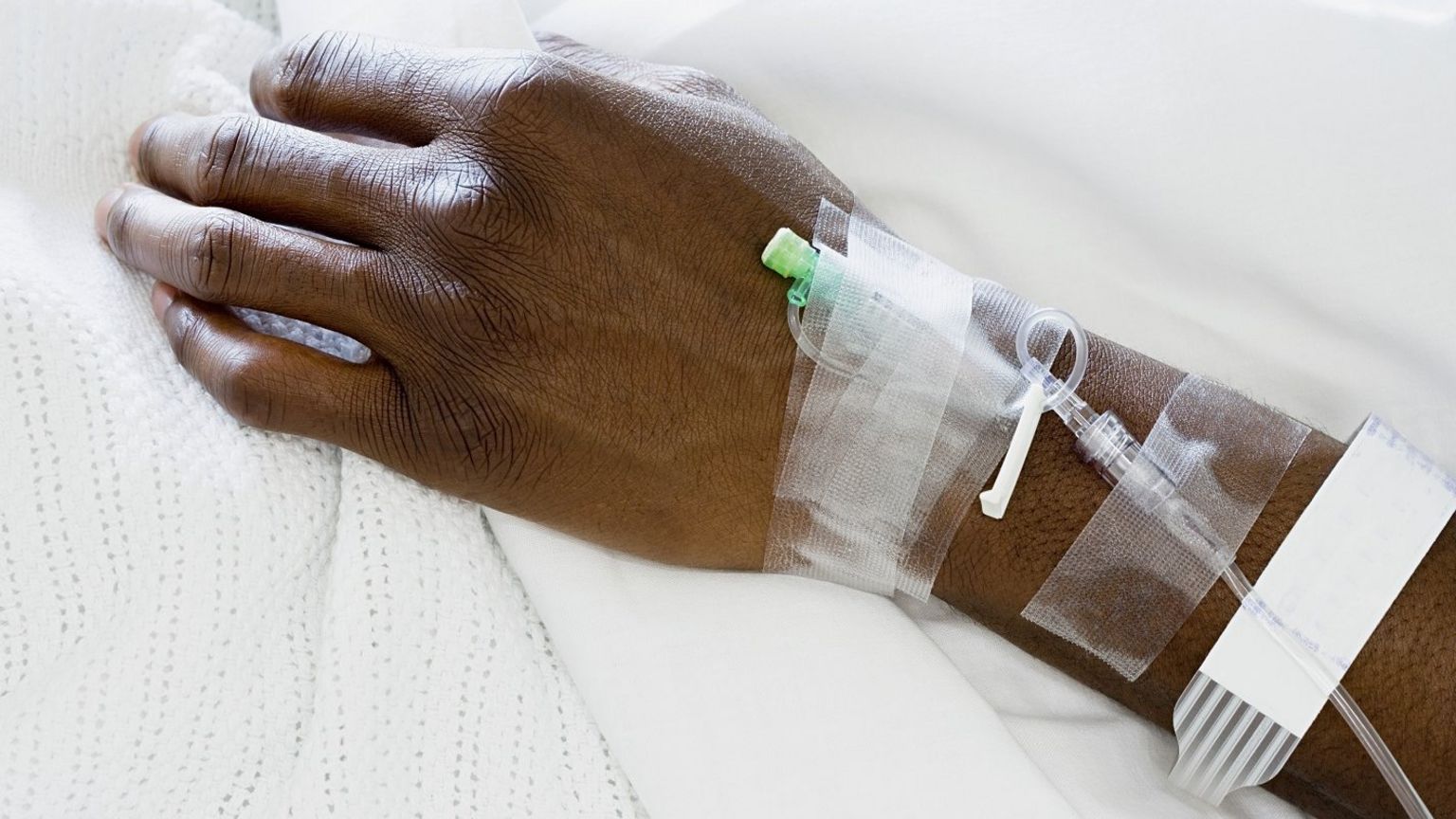 File photo: Black arm with IV drip attached