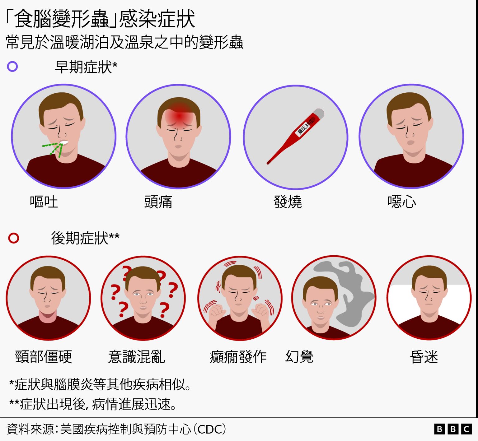 视觉新闻图表展示感染症状，包括：呕吐、头痛、发烧、恶心、颈部僵硬、意识混乱、癫痫发作、幻觉及昏迷。每项症状均以圆形框中的人物图像作视觉化呈现。