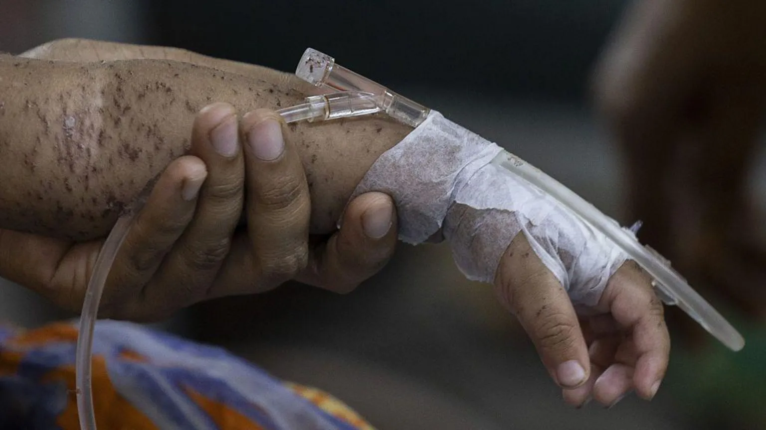 Cientos de niños mueren en cuestión de meses a medida que aumentan los casos de sarampión en Bangladesh.
