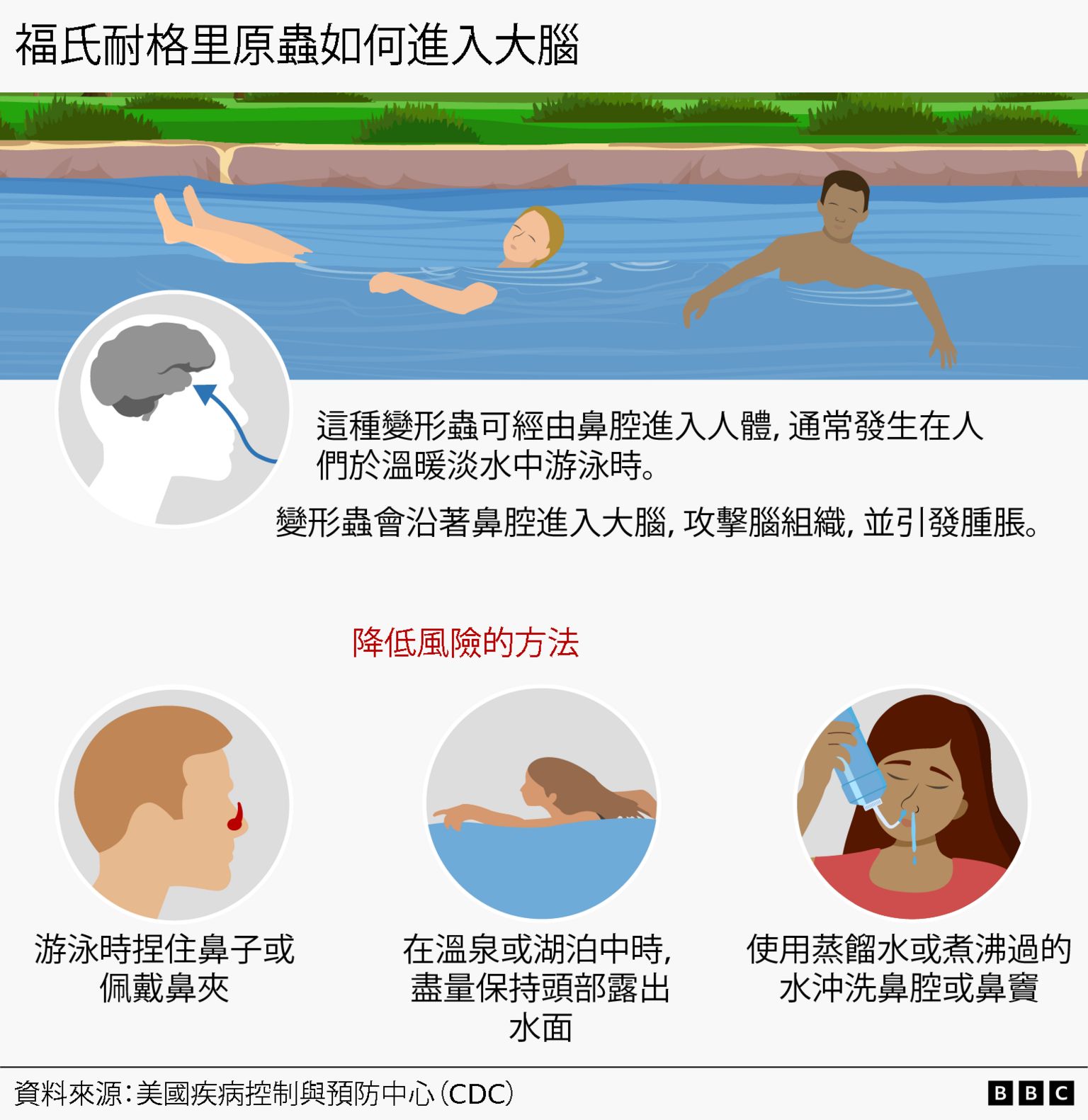 视觉新闻图表展示福氏耐格里原虫如何进入大脑。