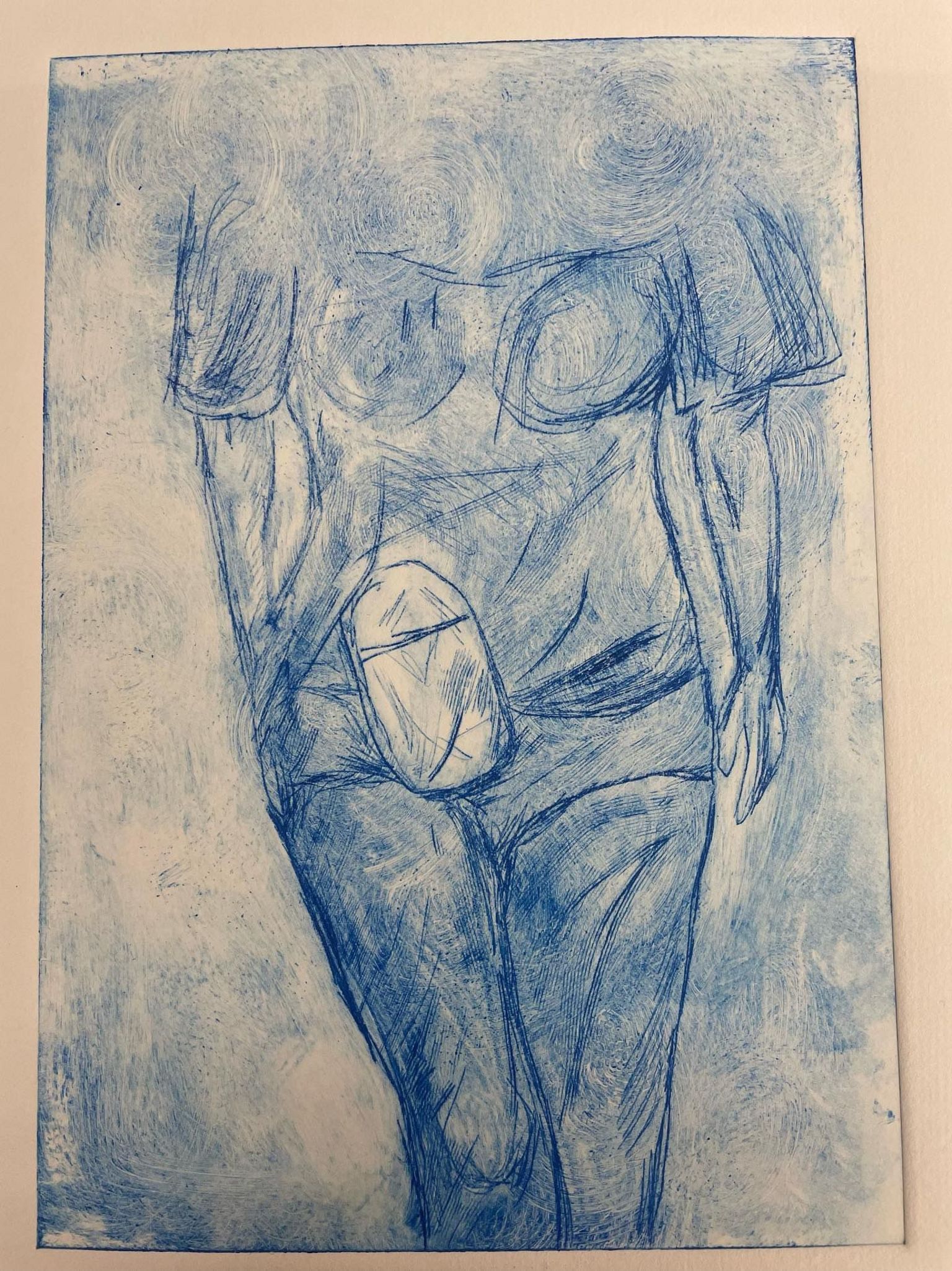 A drawing of a clothed woman's body with an ostomy bag 