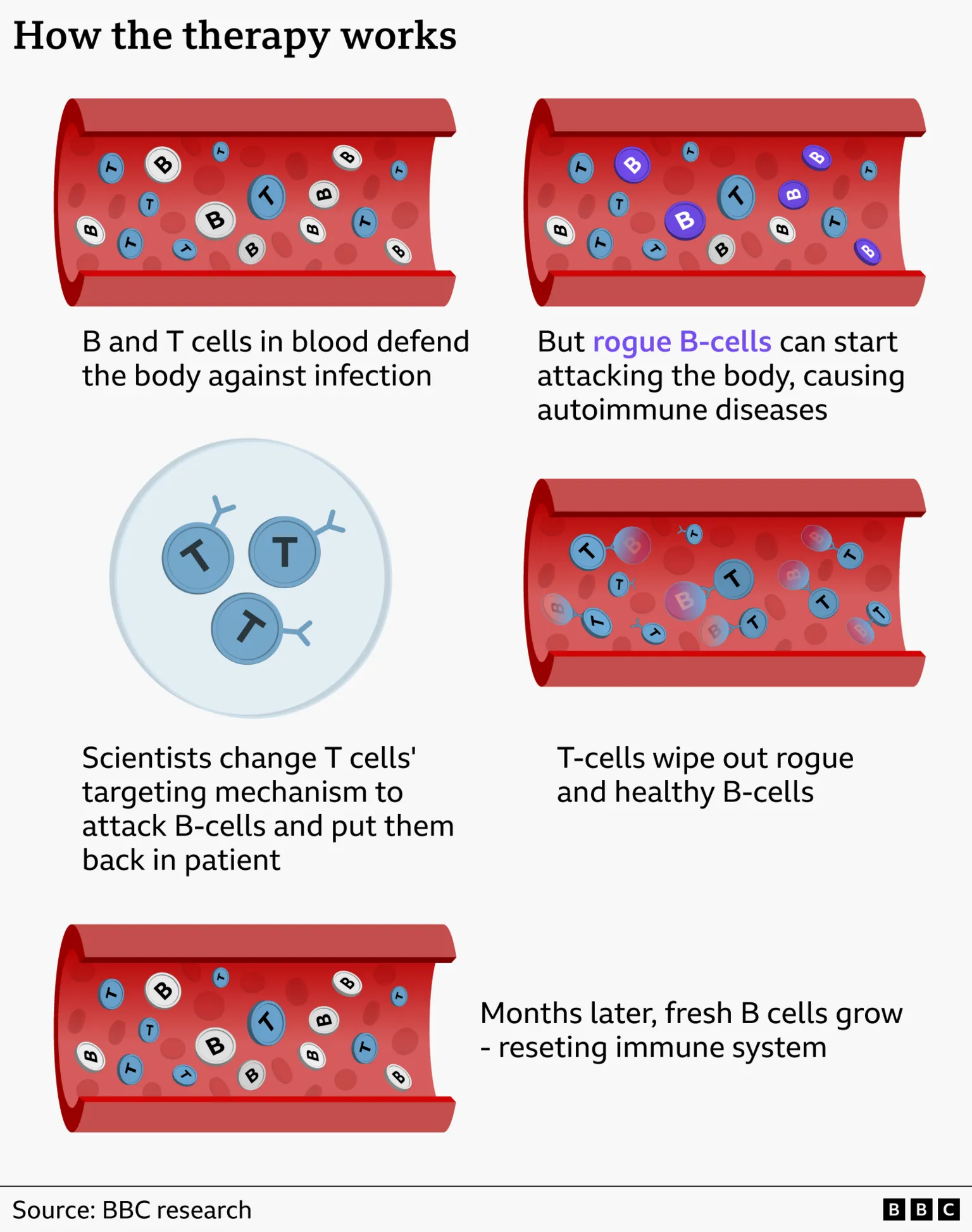 The graphic titled “How the therapy works” is a multi-panel medical illustration showing a step-by-step process inside blood vessels, using red cylindrical tube shapes to represent the bloodstream and circular icons labelled “B” and “T” to represent B cells and T cells. In the top-left panel, blue T cells and grey B cells are shown circulating together with the caption, “B and T cells in blood defend the body against infection,” establishing the normal immune system function. In the top-right panel, some B cells are highlighted in purple to indicate “rogue B-cells,” accompanied by text explaining that these abnormal cells can attack the body and cause autoimmune disease. The middle section shows a simplified lab-like circle containing T cells, alongside the text “Scientists change T cells' targeting mechanism to attack B-cells and put them back in patient,” indicating that T cells are engineered to target all B cells. In the next panel, modified T cells are shown destroying both normal and rogue B cells inside the bloodstream, with the caption “T-cells wipe out rogue and healthy B-cells.” Finally, the bottom panel shows the bloodstream repopulated with new B cells and T cells, with the text “Months later, fresh B cells grow – resetting immune system,” illustrating recovery and immune system reset, and a small note at the bottom credits “Source: BBC research” along with a BBC logo.
