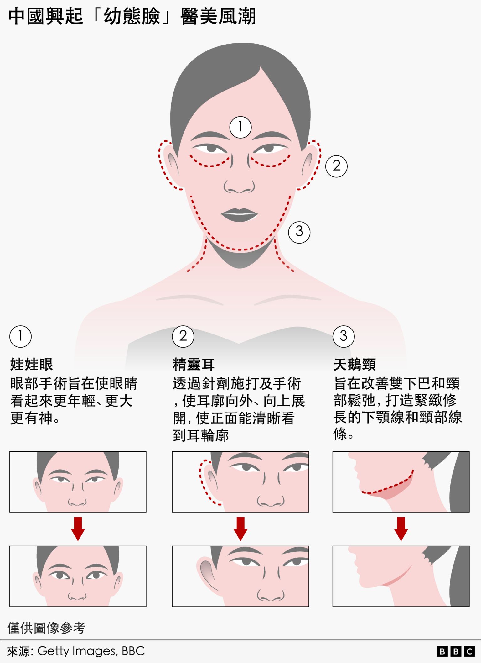 图表