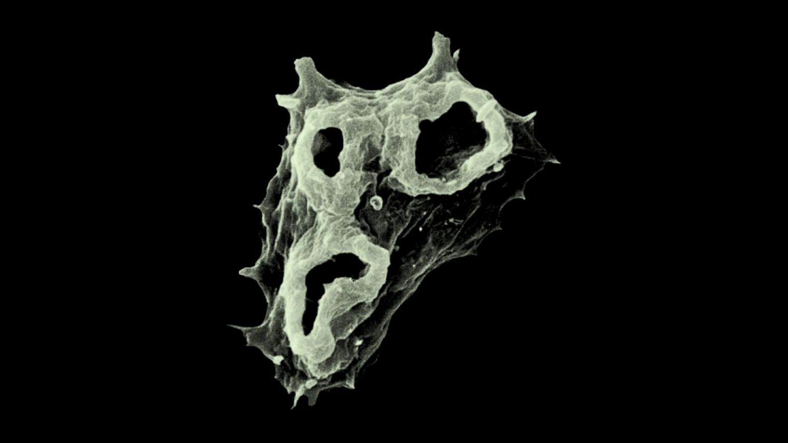 被称为“食脑变形虫”的福氏耐格里原虫（Naegleria fowleri）显微放大影像，其外观呈现近似小丑般的表情，背景为黑色。