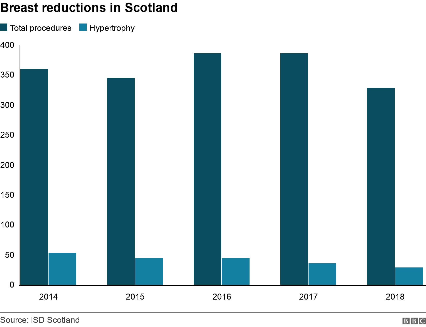 Breast reductions in Scotland. .  .