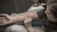 scarred girl