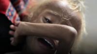 Saleem, a child in Yemen