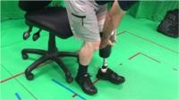 John putting on his prosthetic